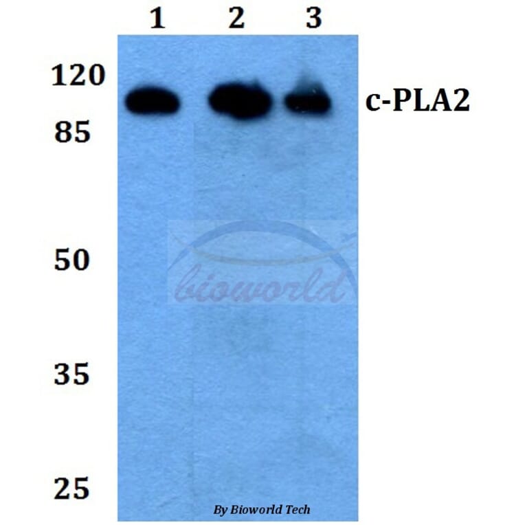 Anti-c-PLA2 (N499) Antibody from Bioworld Technology (BS1434) - Antibodies.com