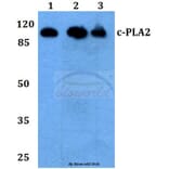 Anti-c-PLA2 (N499) Antibody from Bioworld Technology (BS1434) - Antibodies.com