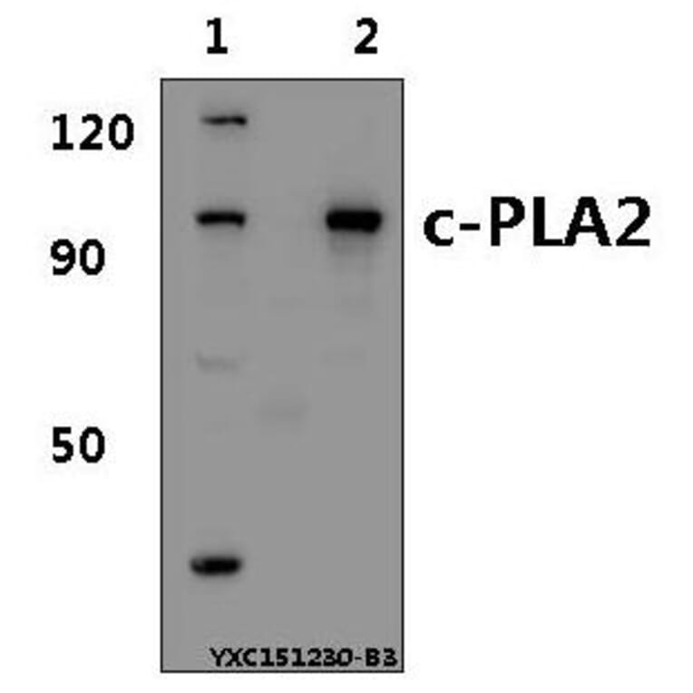 Anti-c-PLA2 (N499) Antibody from Bioworld Technology (BS1434) - Antibodies.com