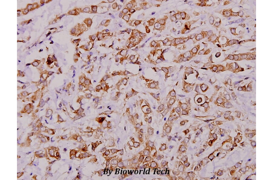 Anti-c-PLA2 (N499) Antibody from Bioworld Technology (BS1434) - Antibodies.com