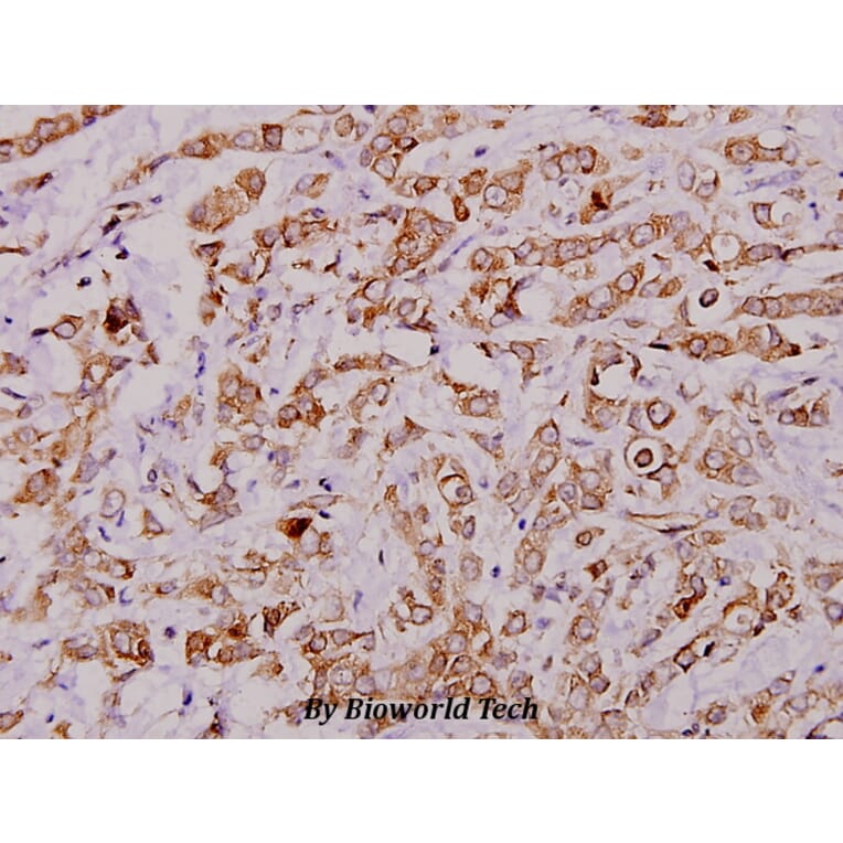 Anti-c-PLA2 (N499) Antibody from Bioworld Technology (BS1434) - Antibodies.com