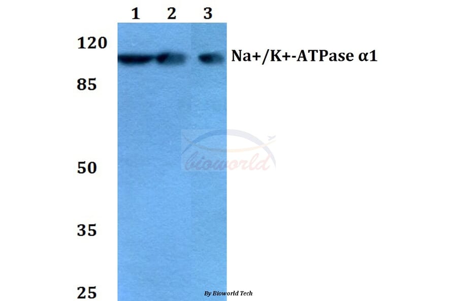 Anti-Na+/K+-ATPase α1 (Y10) Antibody from Bioworld Technology (BS1436) - Antibodies.com