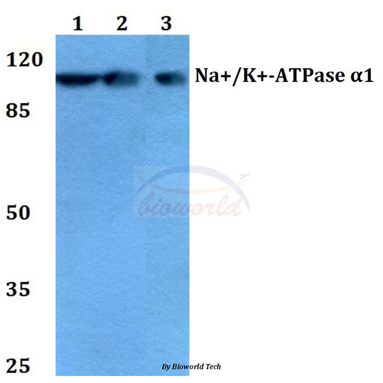 Anti-Na+/K+-ATPase α1 (Y10) Antibody from Bioworld Technology (BS1436) - Antibodies.com