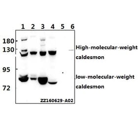 Anti-Caldesmon (S783) Antibody from Bioworld Technology (BS1437) - Antibodies.com
