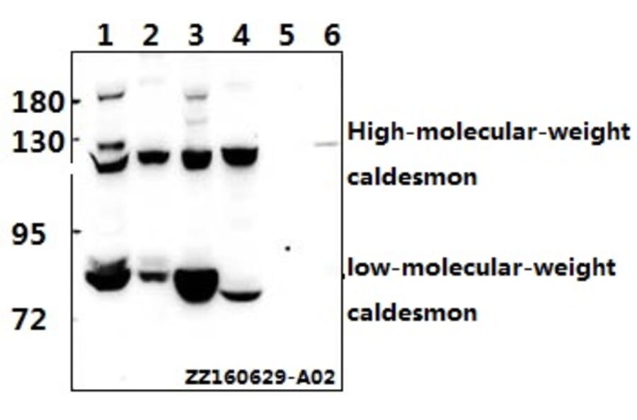 Anti-Caldesmon (S783) Antibody from Bioworld Technology (BS1437) - Antibodies.com