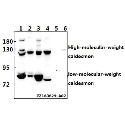 Anti-Caldesmon (S783) Antibody from Bioworld Technology (BS1437) - Antibodies.com