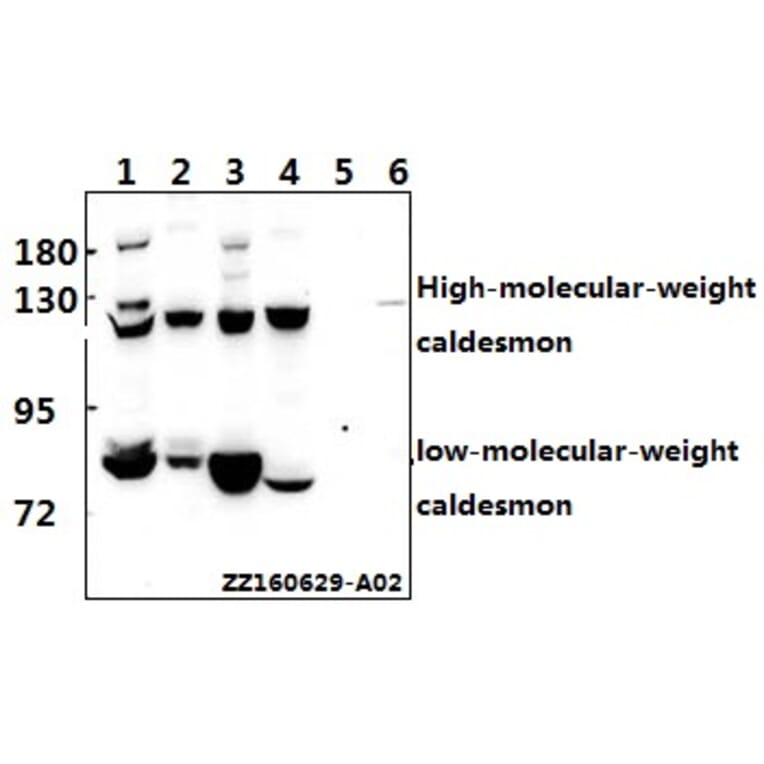 Anti-Caldesmon (S783) Antibody from Bioworld Technology (BS1437) - Antibodies.com