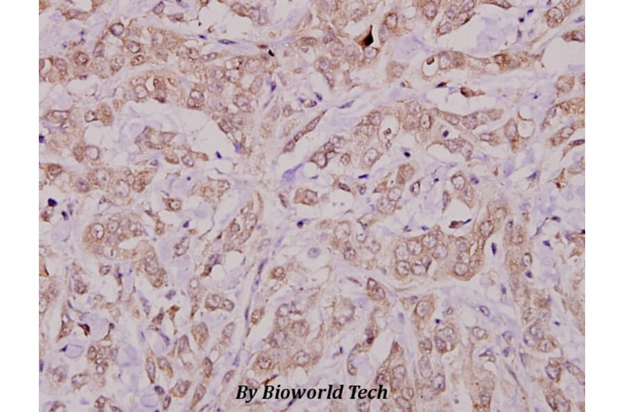 Anti-Cbl (E768) Antibody from Bioworld Technology (BS1439) - Antibodies.com