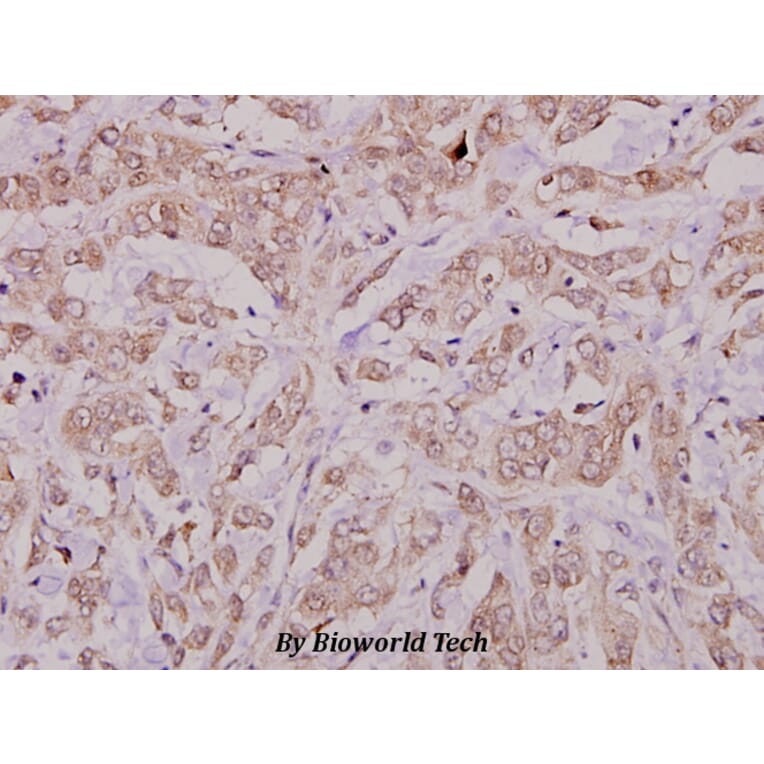 Anti-Cbl (E768) Antibody from Bioworld Technology (BS1439) - Antibodies.com