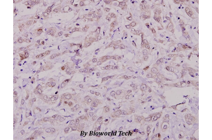 Anti-Cbl (S668) Antibody from Bioworld Technology (BS1440) - Antibodies.com