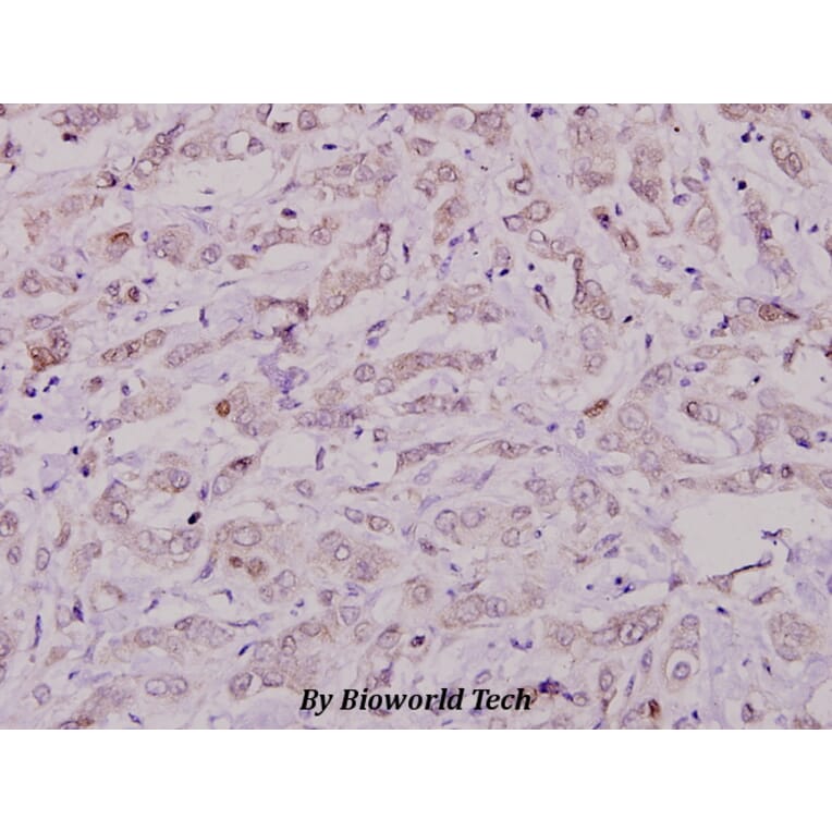 Anti-Cbl (S668) Antibody from Bioworld Technology (BS1440) - Antibodies.com