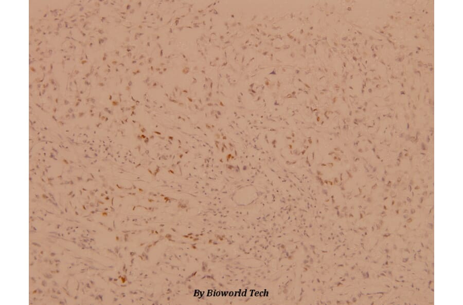 Anti-FoxO1/3/4 (P18) Antibody from Bioworld Technology (BS1442) - Antibodies.com