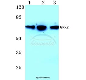 Anti-GRK2 (T23) Antibody from Bioworld Technology (BS1443) - Antibodies.com