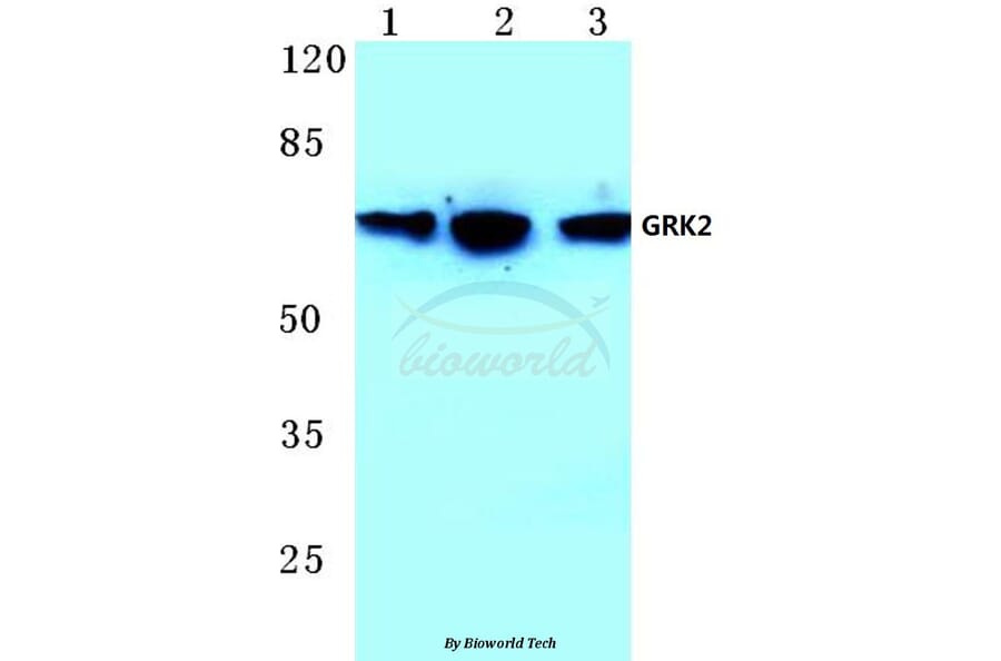 Anti-GRK2 (T23) Antibody from Bioworld Technology (BS1443) - Antibodies.com