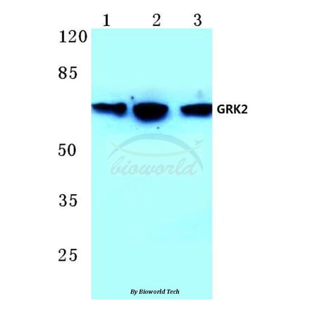 Anti-GRK2 (T23) Antibody from Bioworld Technology (BS1443) - Antibodies.com