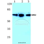 Anti-GRK2 (T23) Antibody from Bioworld Technology (BS1443) - Antibodies.com