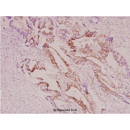 Anti-IRS-1 (V317) Antibody from Bioworld Technology (BS1445) - Antibodies.com