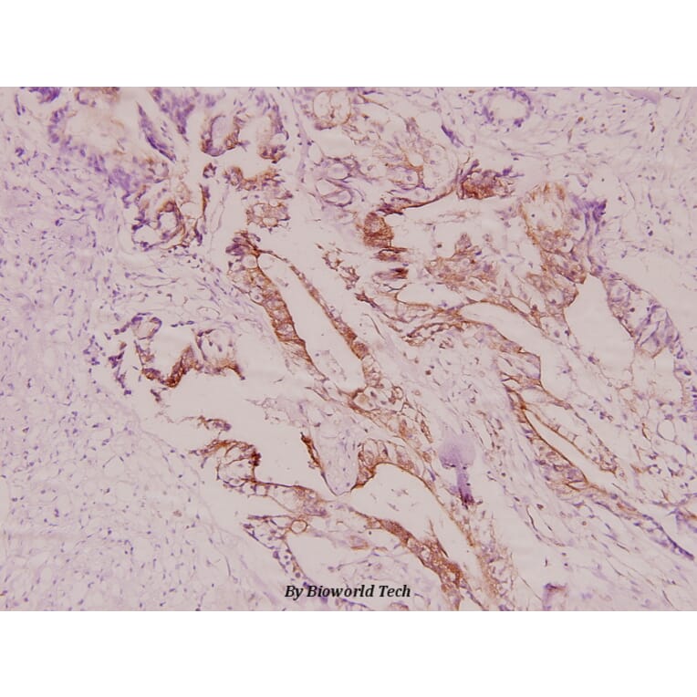 Anti-IRS-1 (V317) Antibody from Bioworld Technology (BS1445) - Antibodies.com