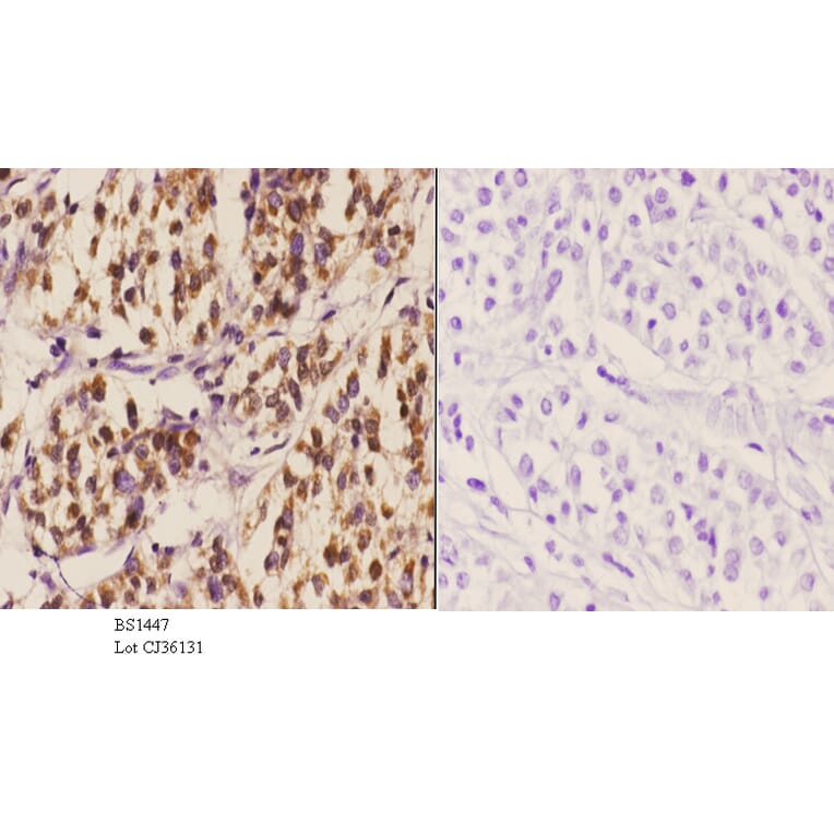 Anti-MDM2 (S160) Antibody from Bioworld Technology (BS1447) - Antibodies.com