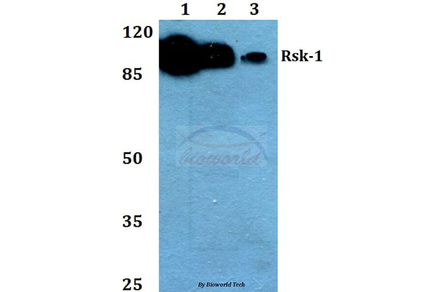 Anti-Rsk-1 (T353) Antibody from Bioworld Technology (BS1448) - Antibodies.com