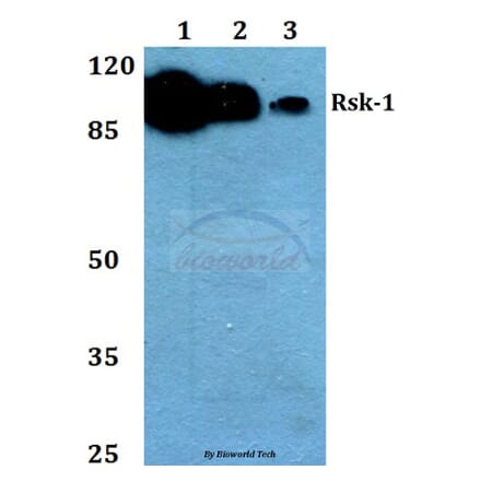 Anti-Rsk-1 (T353) Antibody from Bioworld Technology (BS1448) - Antibodies.com