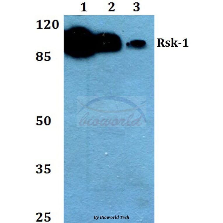 Anti-Rsk-1 (T353) Antibody from Bioworld Technology (BS1448) - Antibodies.com