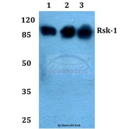 Anti-Rsk-1 (Q374) Antibody from Bioworld Technology (BS1449) - Antibodies.com