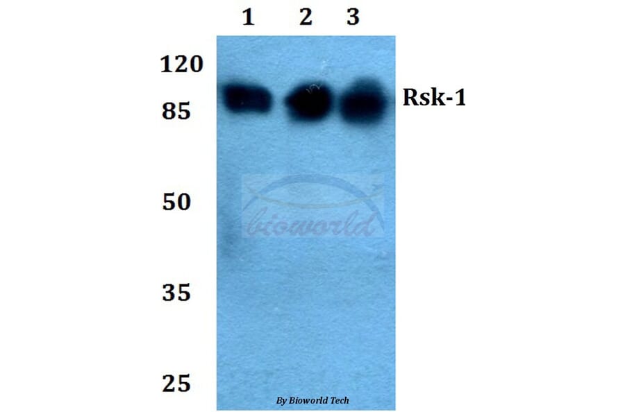 Anti-Rsk-1 (Q374) Antibody from Bioworld Technology (BS1449) - Antibodies.com