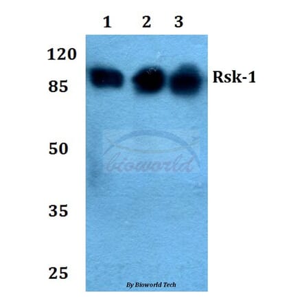 Anti-Rsk-1 (Q374) Antibody from Bioworld Technology (BS1449) - Antibodies.com