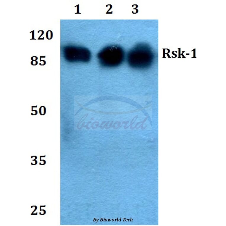 Anti-Rsk-1 (Q374) Antibody from Bioworld Technology (BS1449) - Antibodies.com