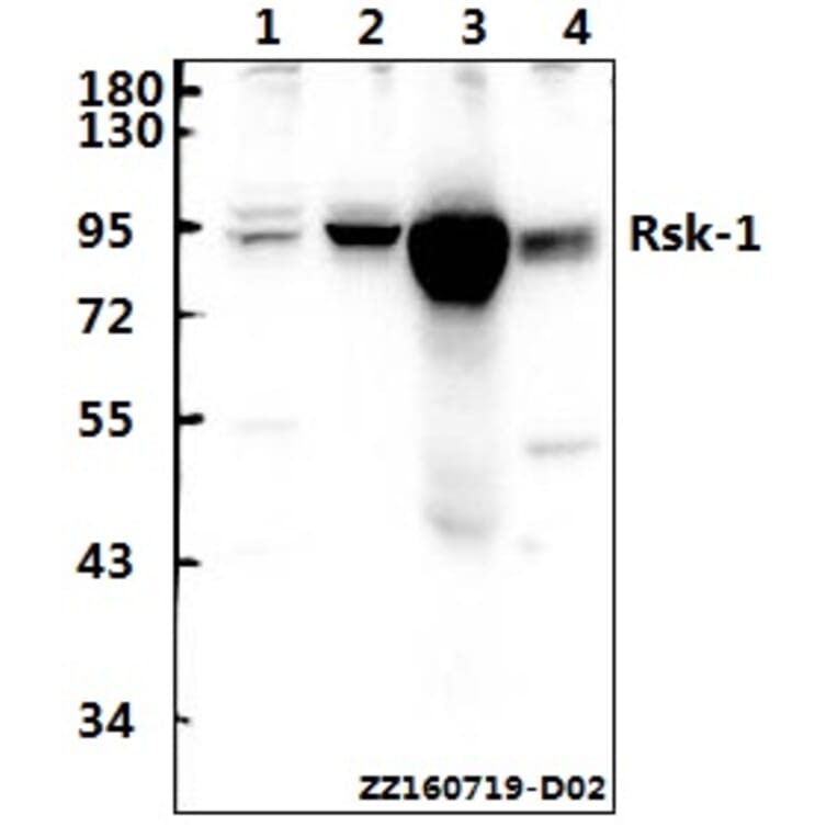 Anti-Rsk-1 (Q374) Antibody from Bioworld Technology (BS1449) - Antibodies.com