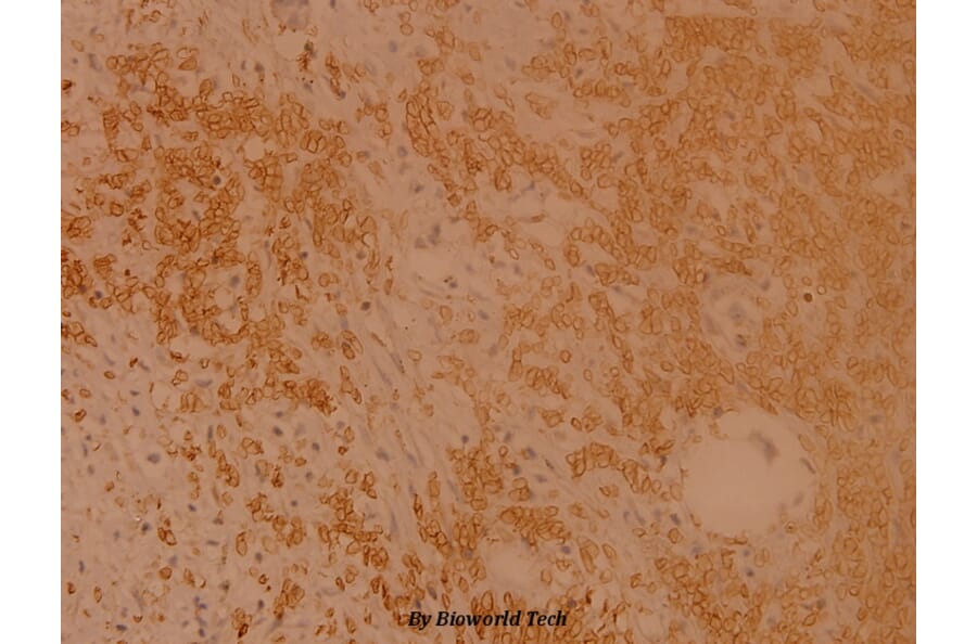 Anti-Rsk-1 (Q374) Antibody from Bioworld Technology (BS1449) - Antibodies.com