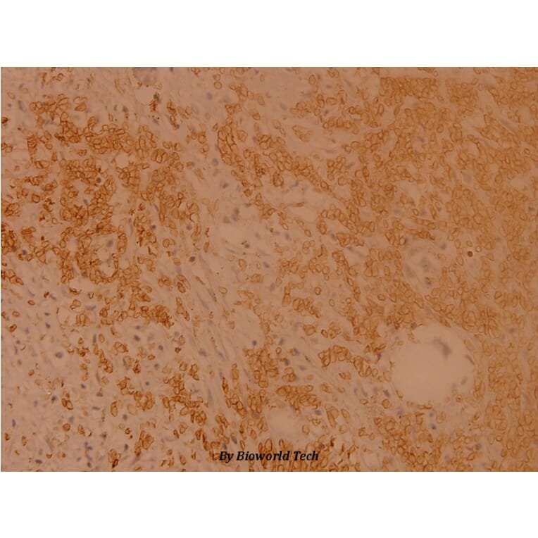 Anti-Rsk-1 (Q374) Antibody from Bioworld Technology (BS1449) - Antibodies.com