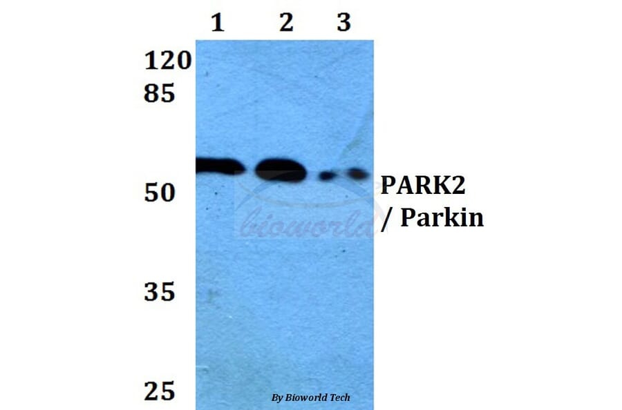 Anti-PARK2 (T125) Antibody from Bioworld Technology (BS1450) - Antibodies.com