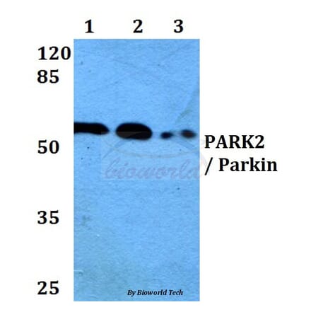 Anti-PARK2 (T125) Antibody from Bioworld Technology (BS1450) - Antibodies.com