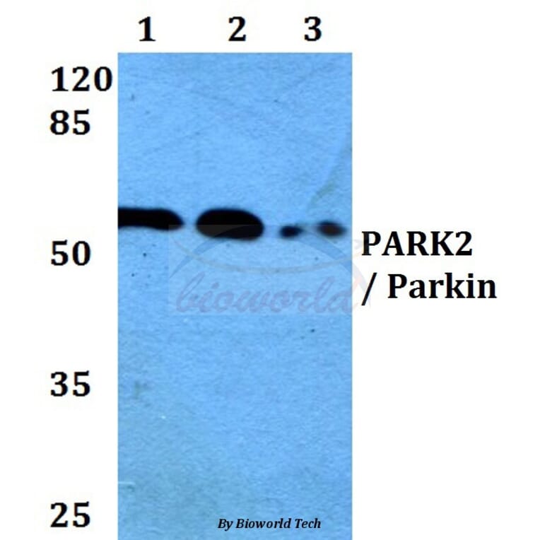 Anti-PARK2 (T125) Antibody from Bioworld Technology (BS1450) - Antibodies.com