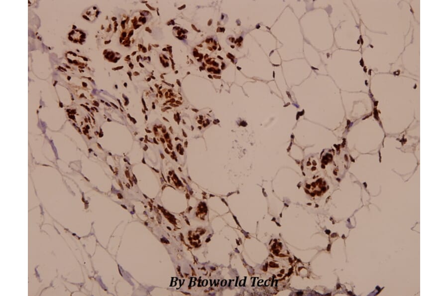 Anti-PARK2 (T125) Antibody from Bioworld Technology (BS1450) - Antibodies.com