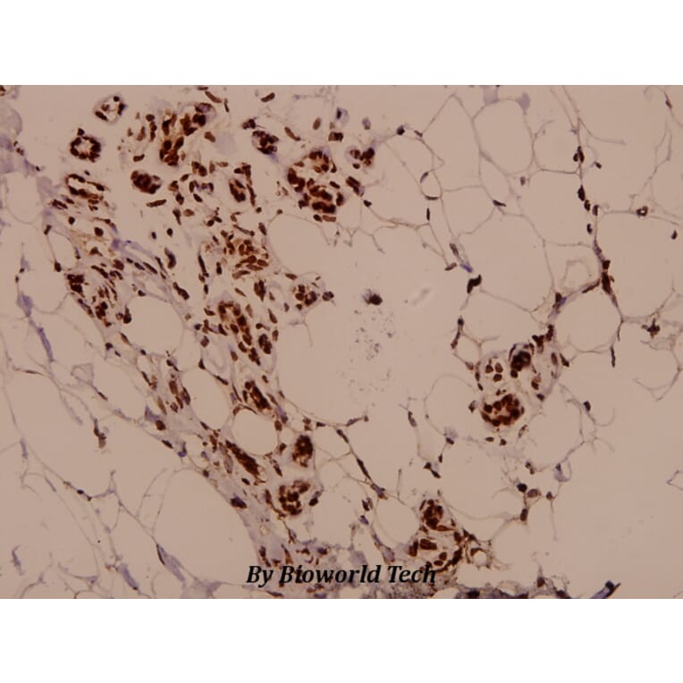 Anti-PARK2 (T125) Antibody from Bioworld Technology (BS1450) - Antibodies.com