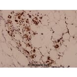 Anti-PARK2 (T125) Antibody from Bioworld Technology (BS1450) - Antibodies.com