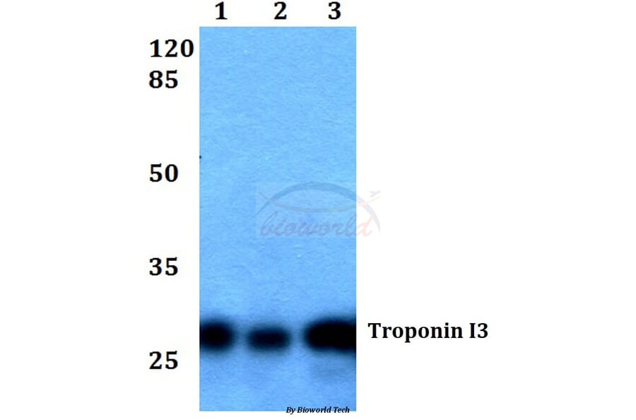 Anti-Troponin I3 (G136) Antibody from Bioworld Technology (BS1453) - Antibodies.com