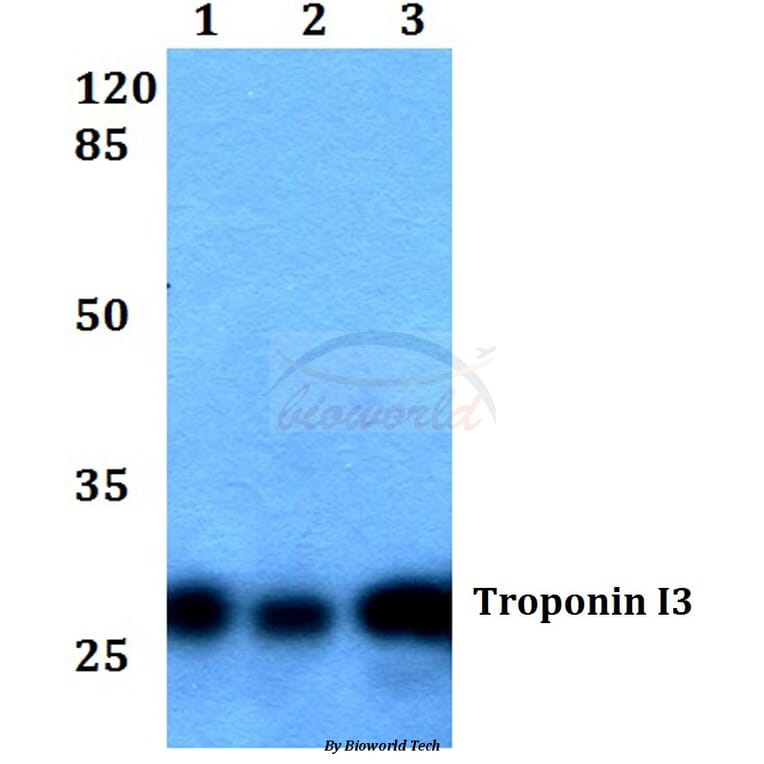 Anti-Troponin I3 (G136) Antibody from Bioworld Technology (BS1453) - Antibodies.com