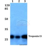 Anti-Troponin I3 (G136) Antibody from Bioworld Technology (BS1453) - Antibodies.com