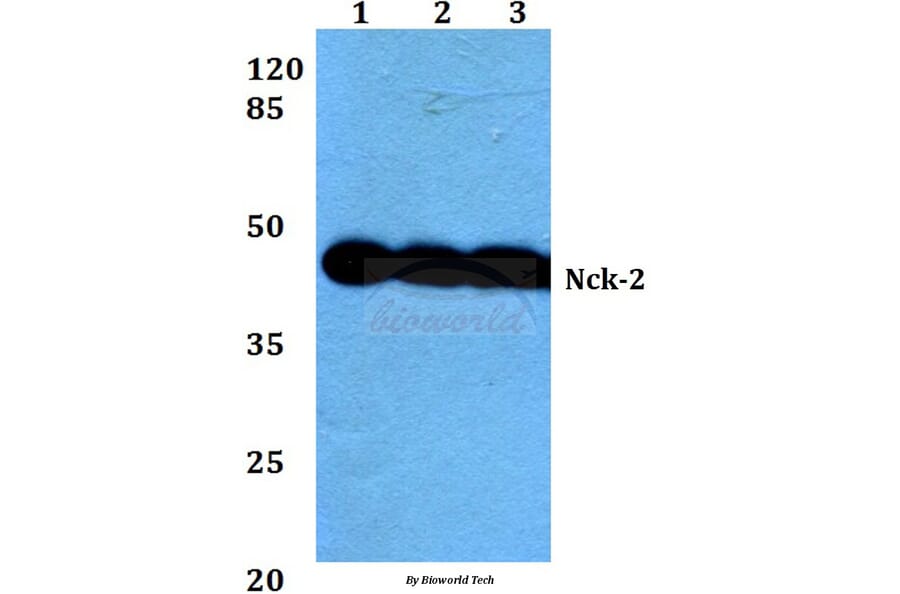 Anti-Nck-2 (I364) Antibody from Bioworld Technology (BS1455) - Antibodies.com