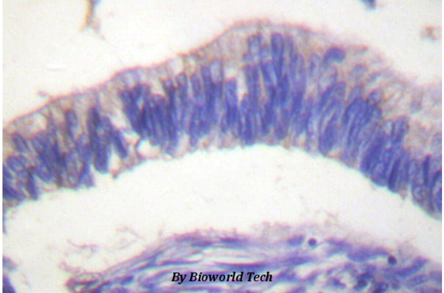 Anti-Nck-2 (I364) Antibody from Bioworld Technology (BS1455) - Antibodies.com
