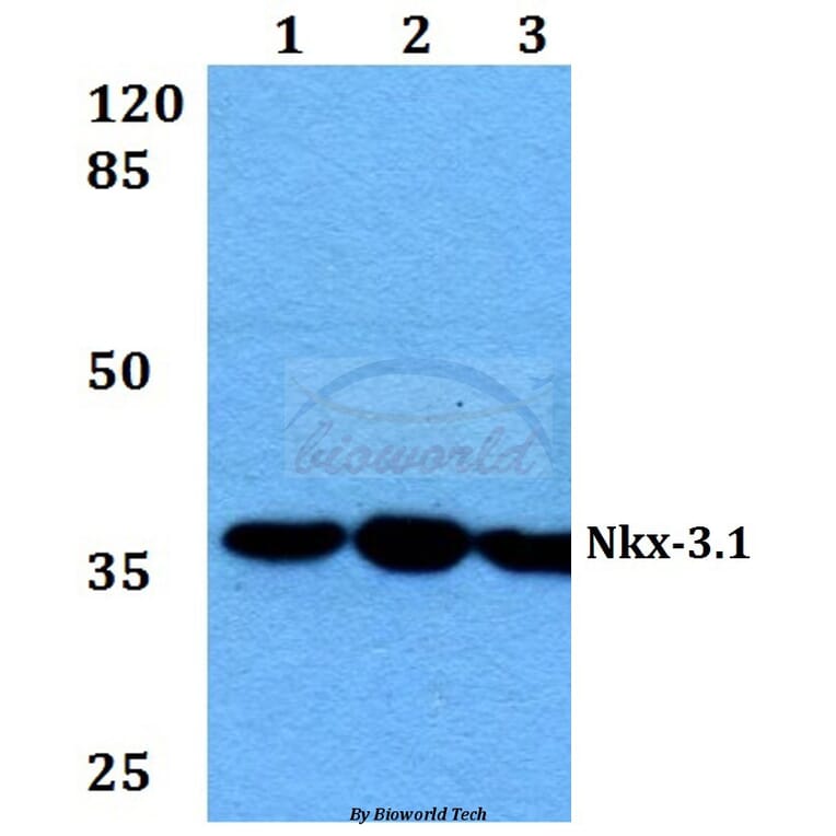 Anti-Nkx-3.1 (L2) Antibody from Bioworld Technology (BS1456) - Antibodies.com