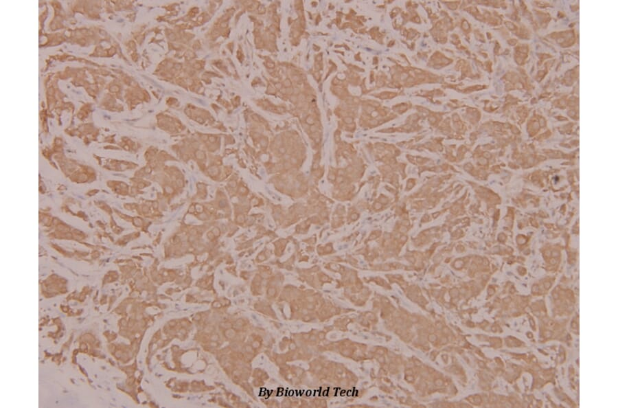 Anti-HYD (T14) Antibody from Bioworld Technology (BS1460) - Antibodies.com