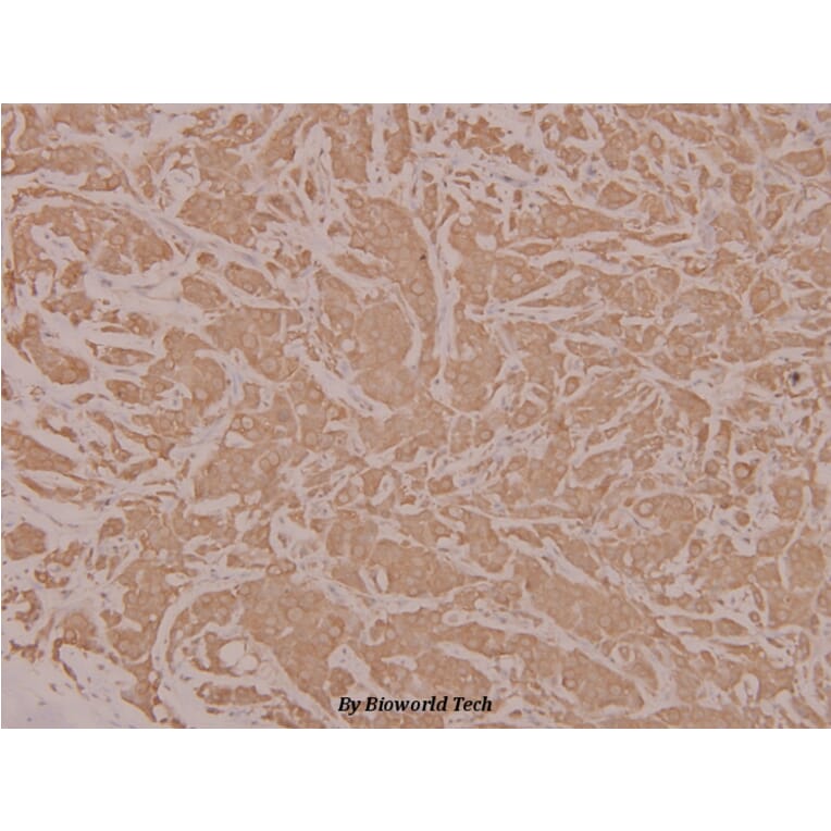 Anti-HYD (T14) Antibody from Bioworld Technology (BS1460) - Antibodies.com