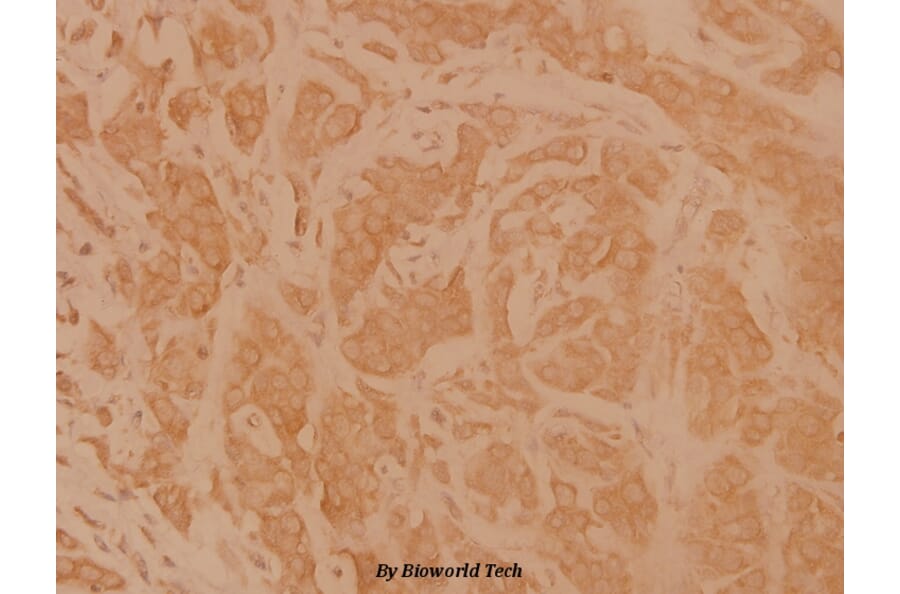 Anti-CD95 (L315) Antibody from Bioworld Technology (BS1461) - Antibodies.com