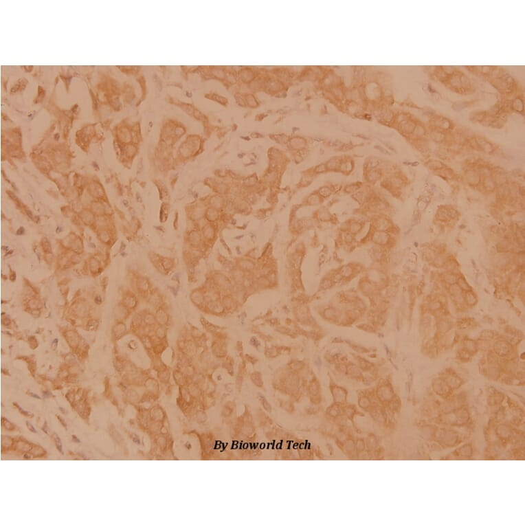 Anti-CD95 (L315) Antibody from Bioworld Technology (BS1461) - Antibodies.com