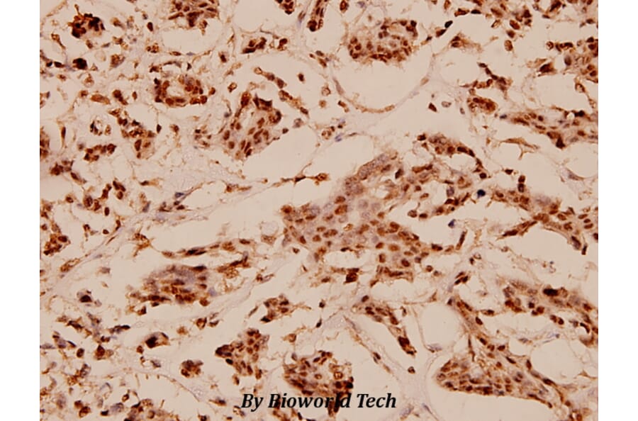 Anti-N-CoR (H76) Antibody from Bioworld Technology (BS1462) - Antibodies.com